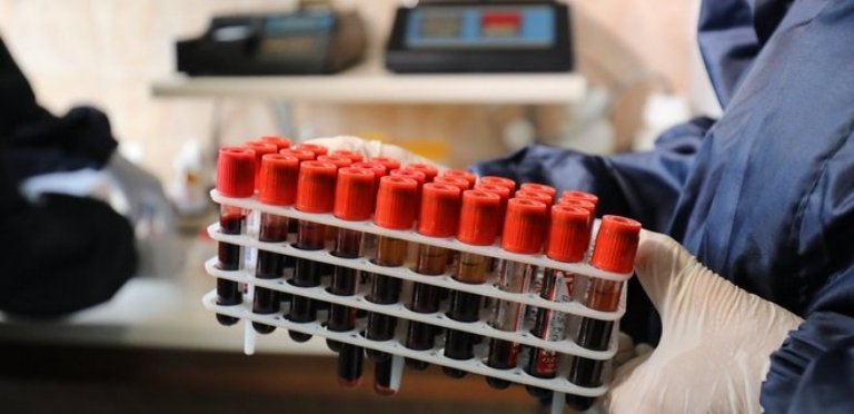  ����������� ����� ������� ������������ 400 ������� covid-19 ����� 