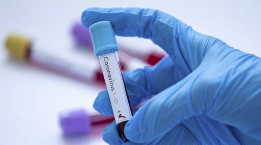  ����������� ��������� ����� ����� ���������� 