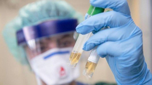  �������� ����������� ������� ����������� covid-19 ������ ������� 